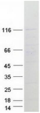 Coomassie blue staining of purified MIB1 protein.